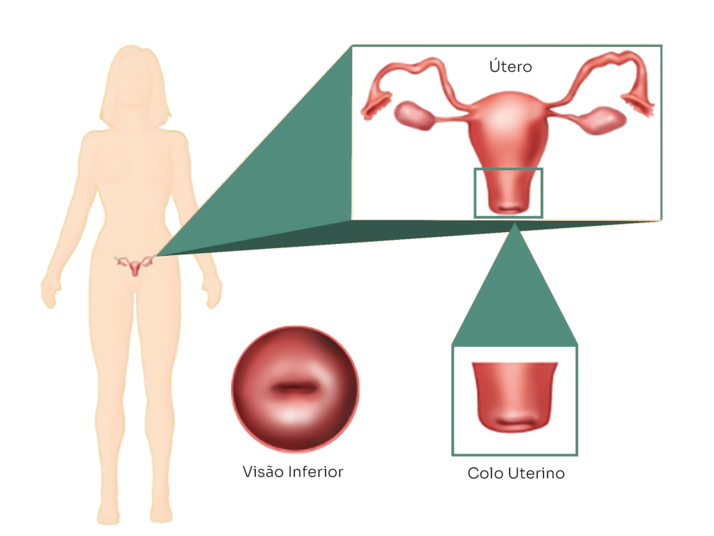 O que é o exame preventivo? Como é feito e o que não fazer antes do exame?